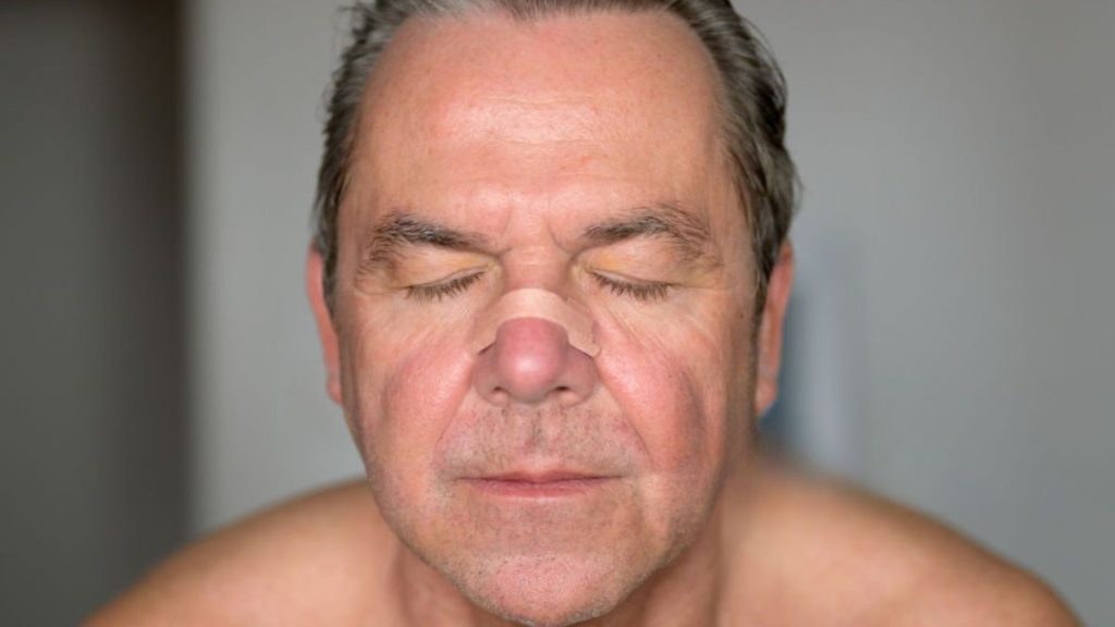 Using a nasal strip to open airways and reduce snoring